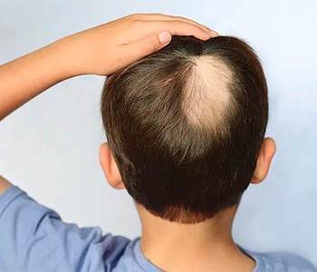 Yuav nyuaj npaum li cas cov neeg Ancient sim kho cov plaub hau poob